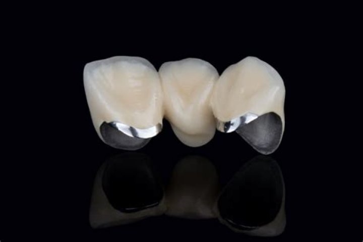 Expert Crown Fabrication: Custom Crowns & Jewelry