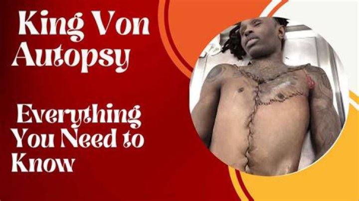 Is King Von Alive? A Deep Dive into the Life and Legacy of the Late Rapper