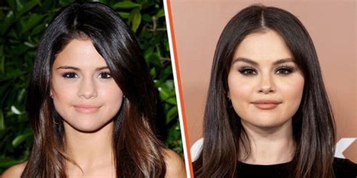 Selena Gomez and Breast Augmentation: A Comprehensive Insight
